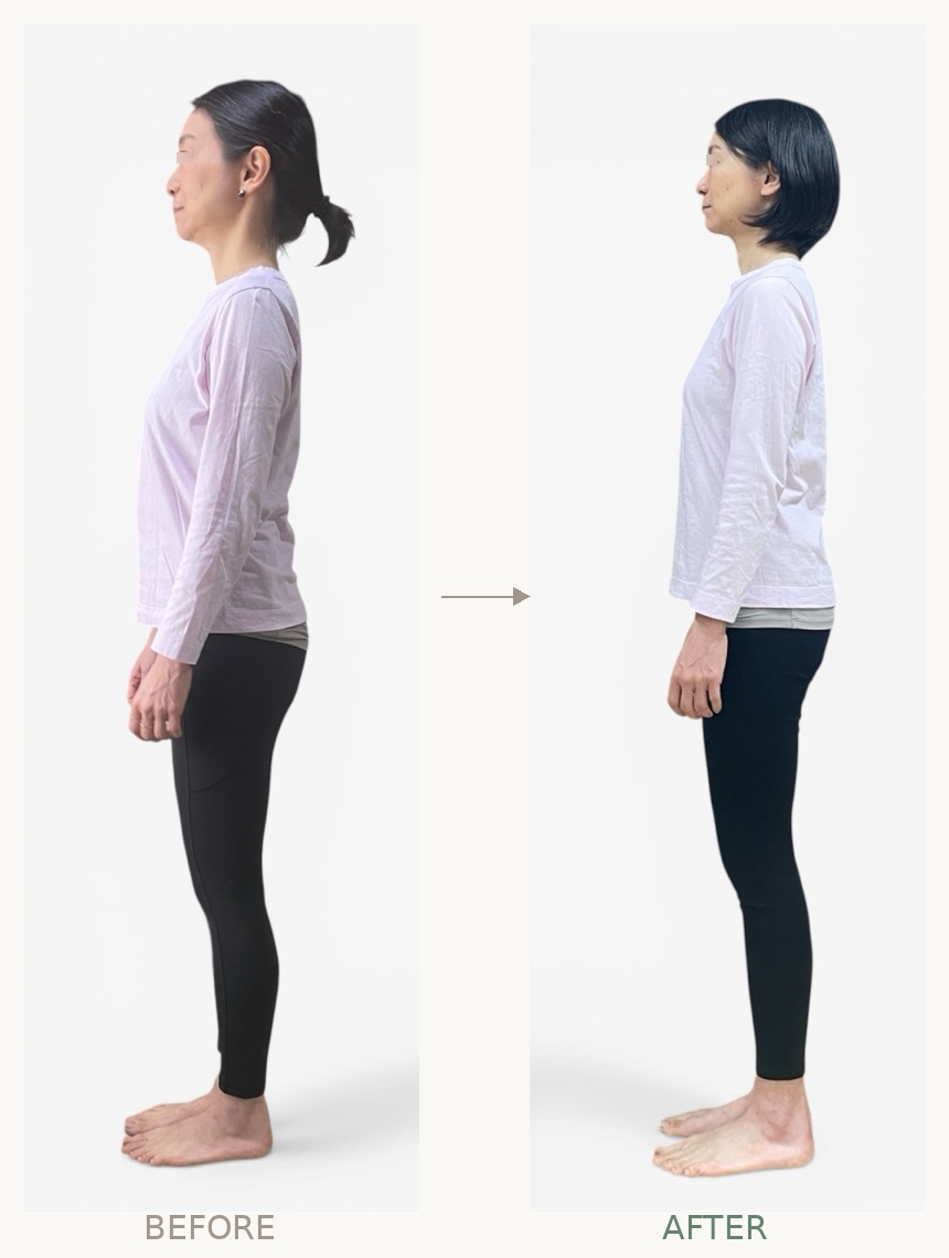 姿勢の変化 before after