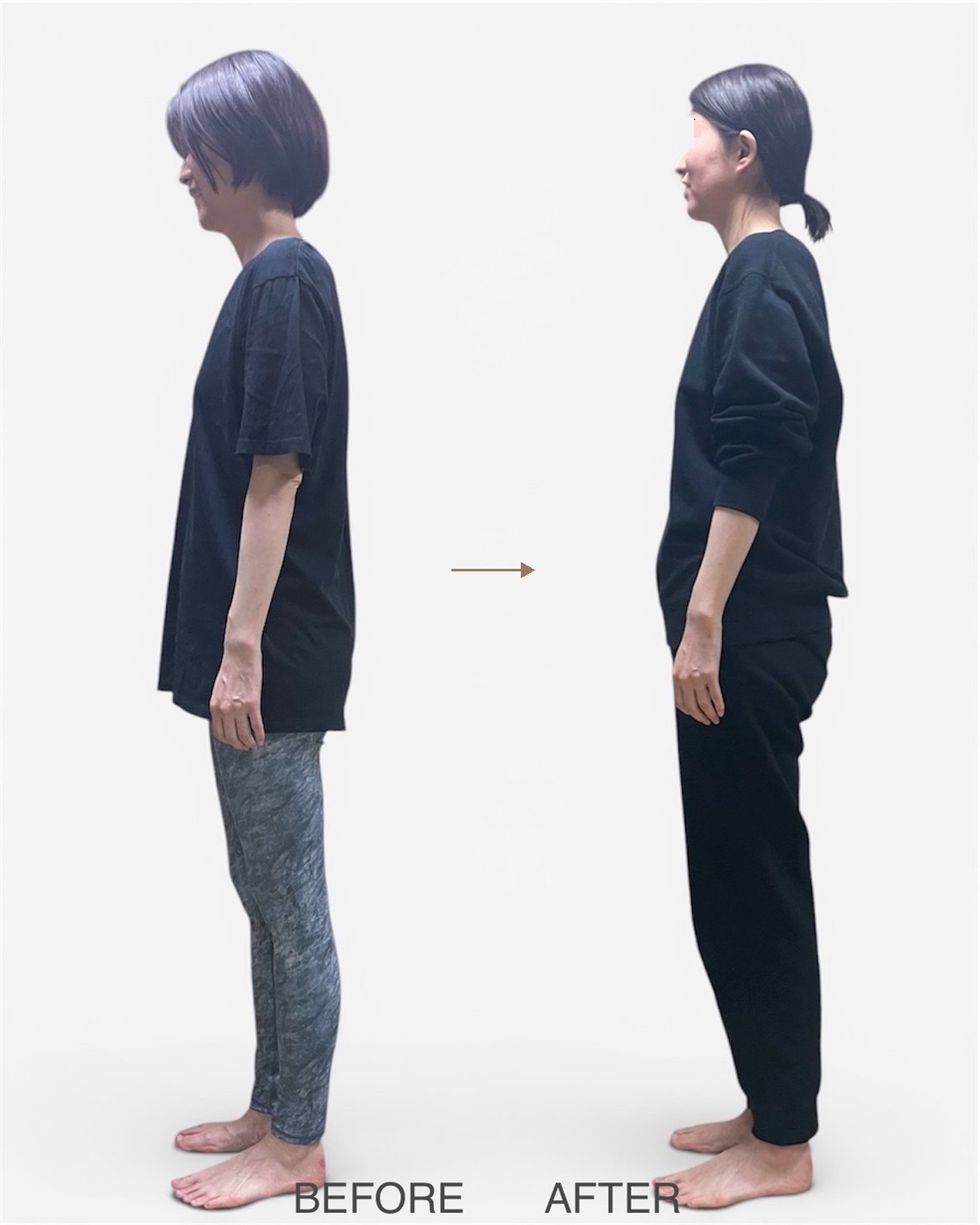 姿勢の変化 before after